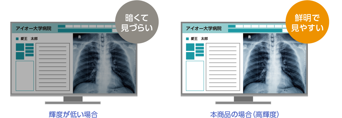 高輝度パネルを採用した医療参照用ディスプレイ