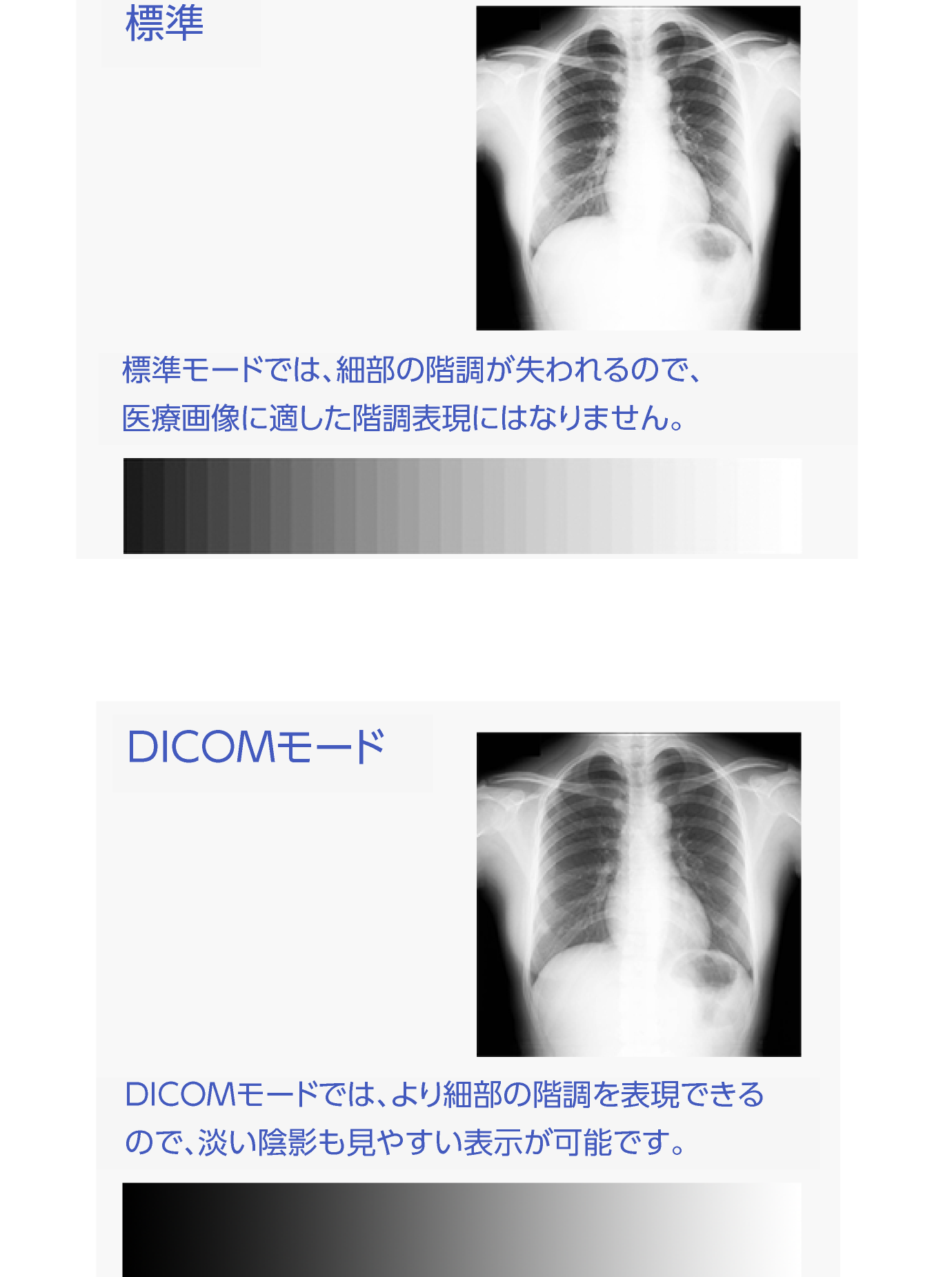 DICOMモードなら、より細部の階調も表現