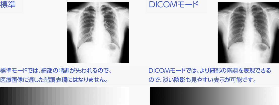 DICOMモードなら、より細部の階調も表現