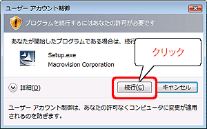 Windows VistaTMŃ[UAJEg̉ʂ\ꂽꍇ[s]NbN܂B