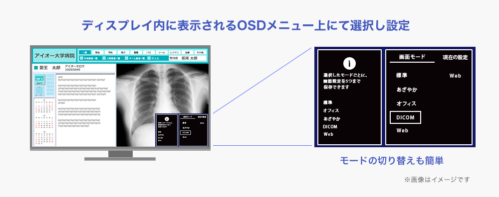 DICOMガンマカーブ表示可能