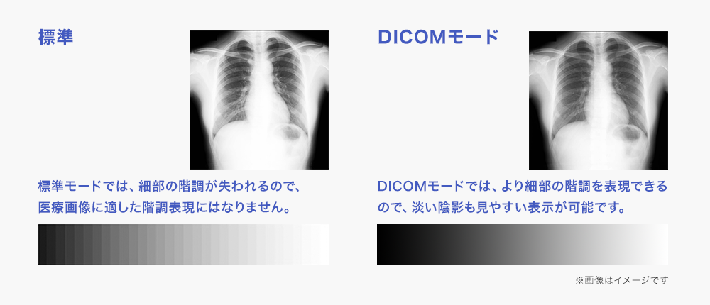 DICOMモードなら、より細部の階調も表現される！