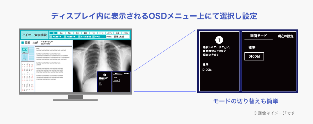 DICOMガンマカーブ表示可能