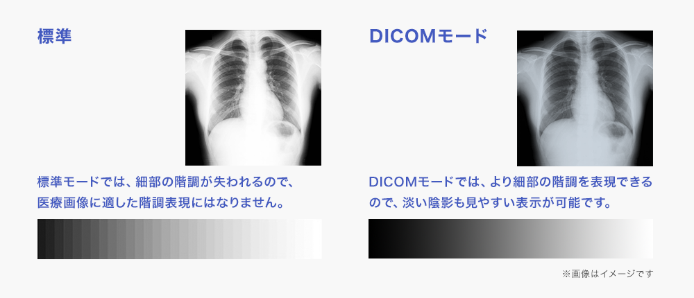 DICOMモードなら、より細部の階調も表現される！